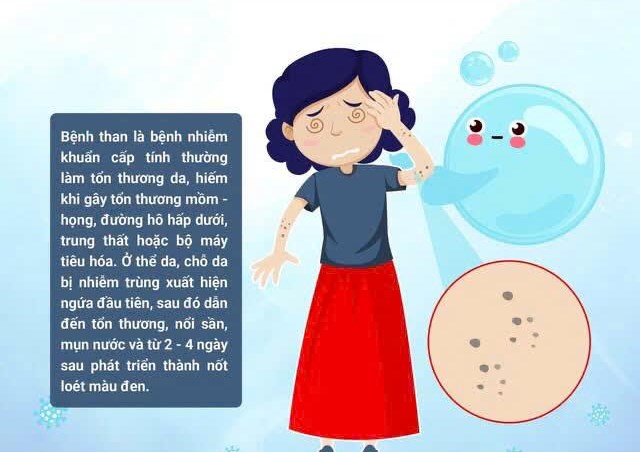 PHÒNG, CHỐNG BỆNH THAN NHỮNG ĐIỀU CẦN BIẾT